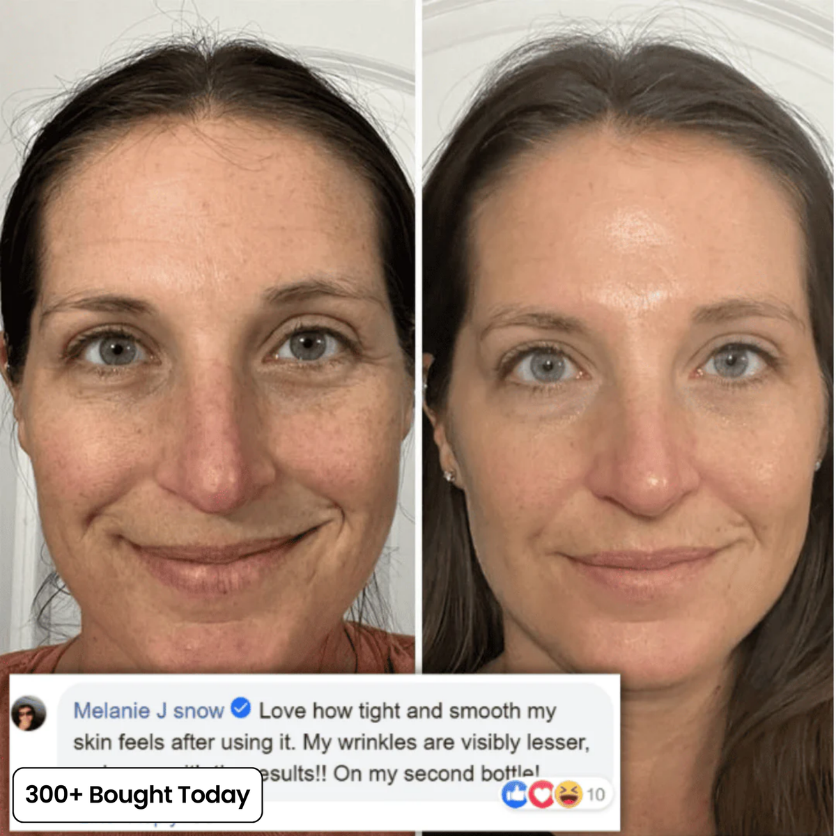 Transform Wrinkles, Fine Lines, And Tired Creases Naturally
